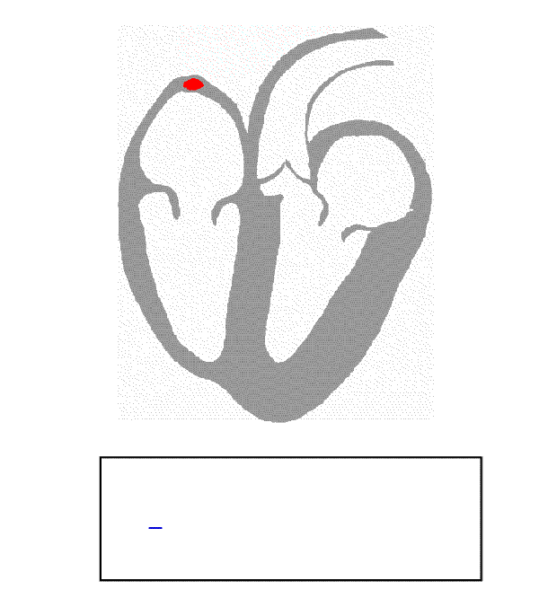 心电图波形产生过程的动画 [1]
