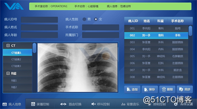 数字化手术室系统