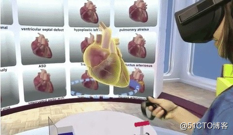 除了模拟手术教学，VR在医疗领域如何应用？
