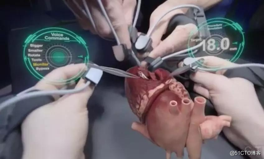 除了模拟手术教学，VR在医疗领域如何应用？