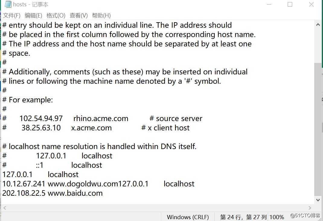 DNS server configuration --- hosts file