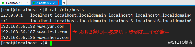 Linuxのネットワークサービス（コマンドの完全な説明は、良心を作成するには、値します！）