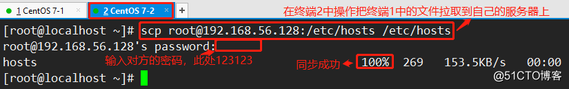 Linuxのネットワークサービス（コマンドの完全な説明は、良心を作成するには、値します！）