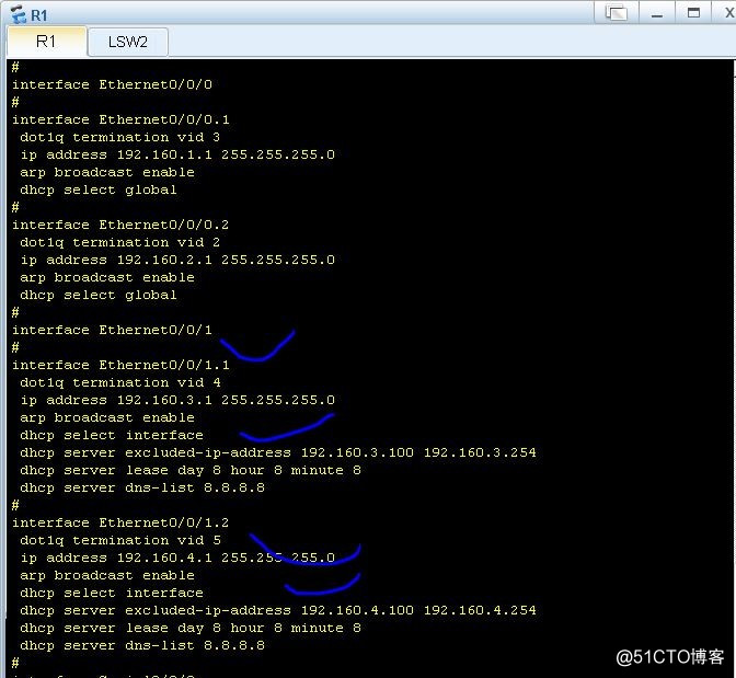 Huawei assigned DHCP IP configuration, global mode, interface mode
